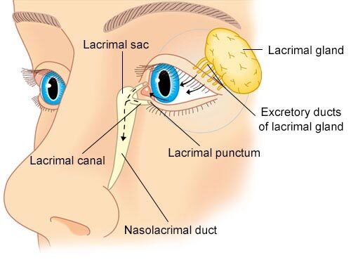 Tear Gland Inflammation (Dacryoadenitis)