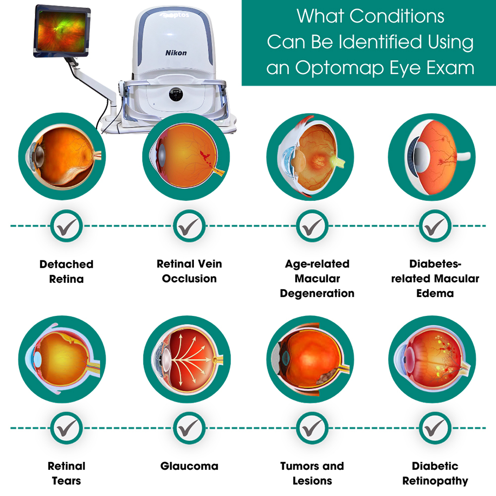 What Conditions Can Be Identified Using an Optomap Eye Exam