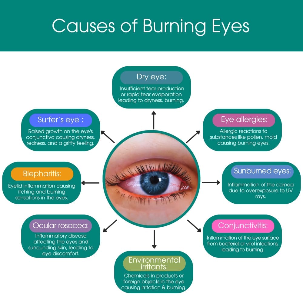 Burning Eyes Treatment NYC | Treatment for Burning Eyes in Downtown ...