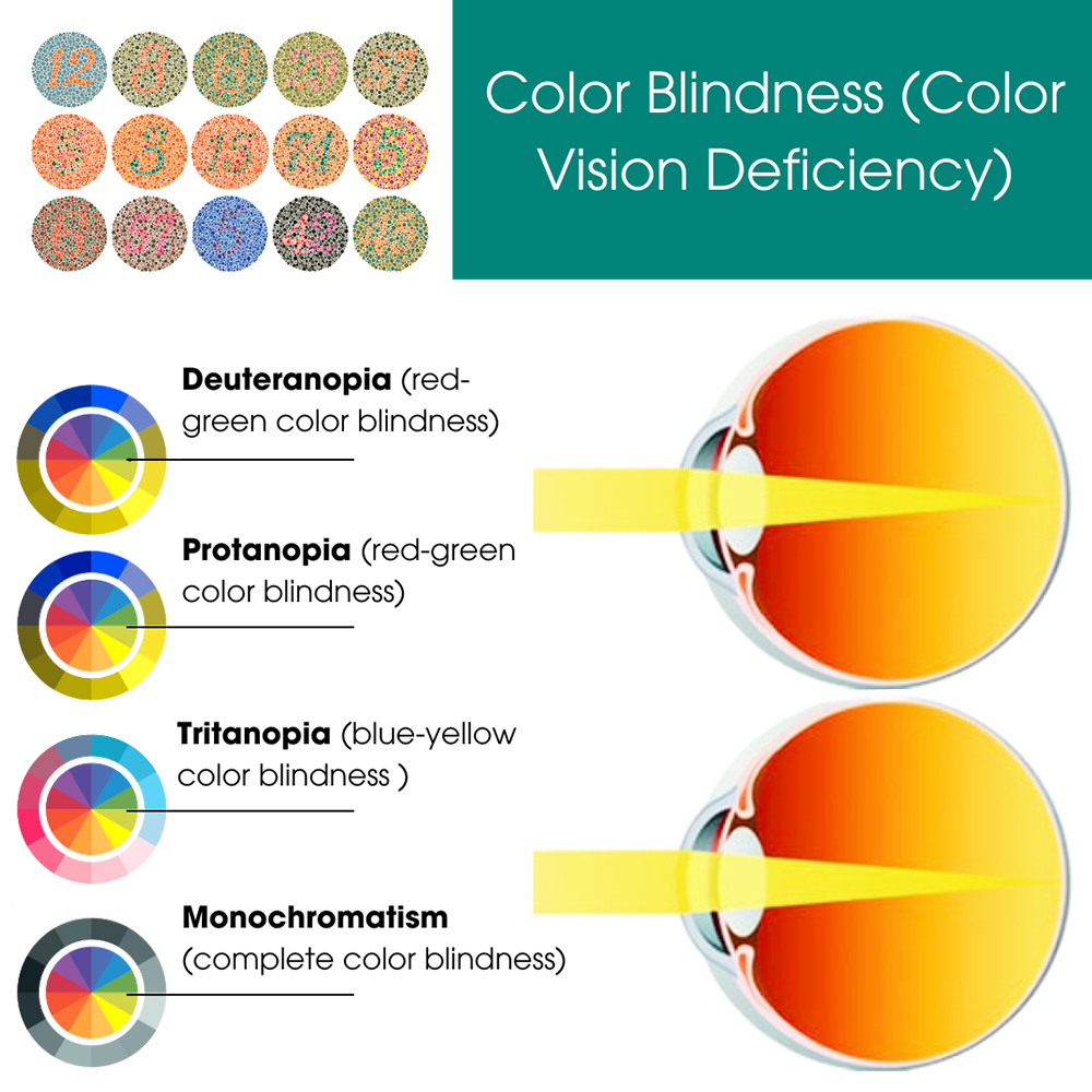 Color Blindness Treatment NYC | Color Blind Glasses Downtown Manhattan