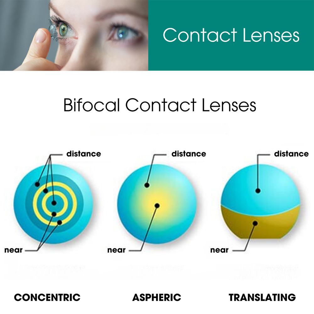 Contact Lenses