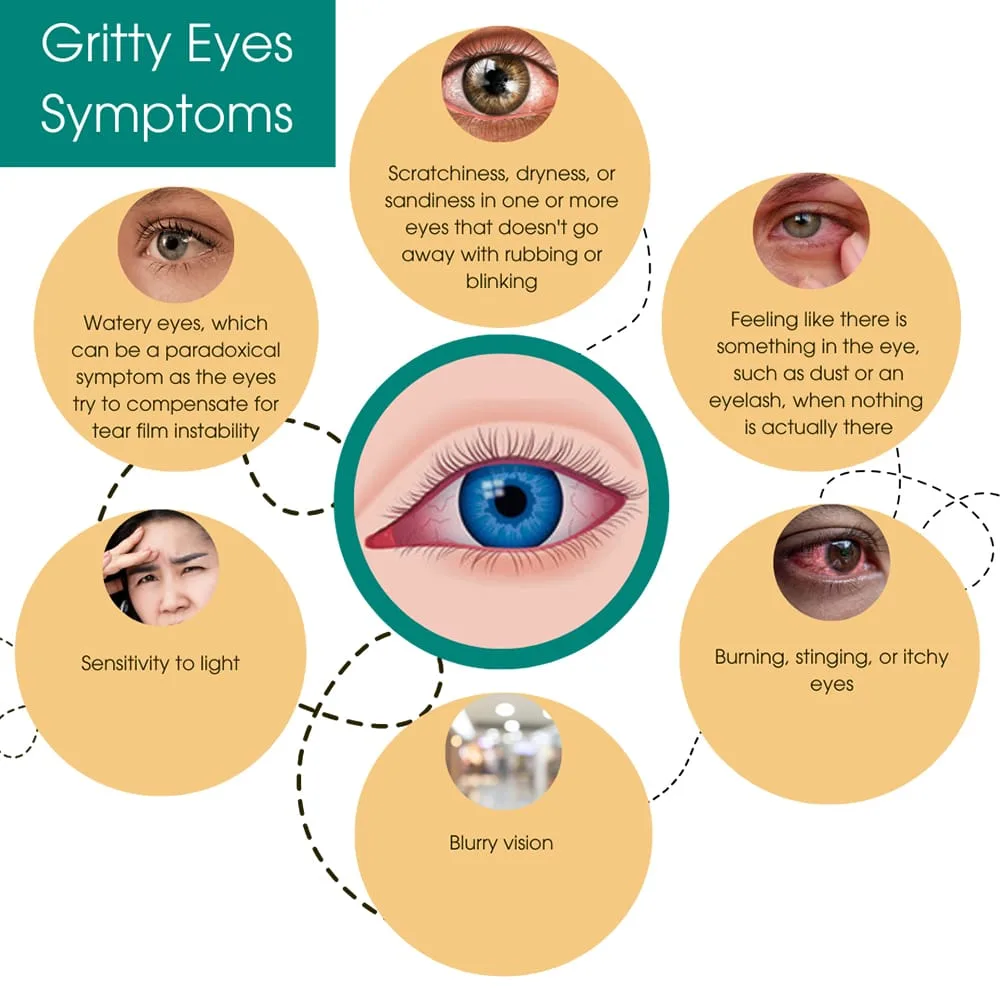 Gritty Eyes Symptoms