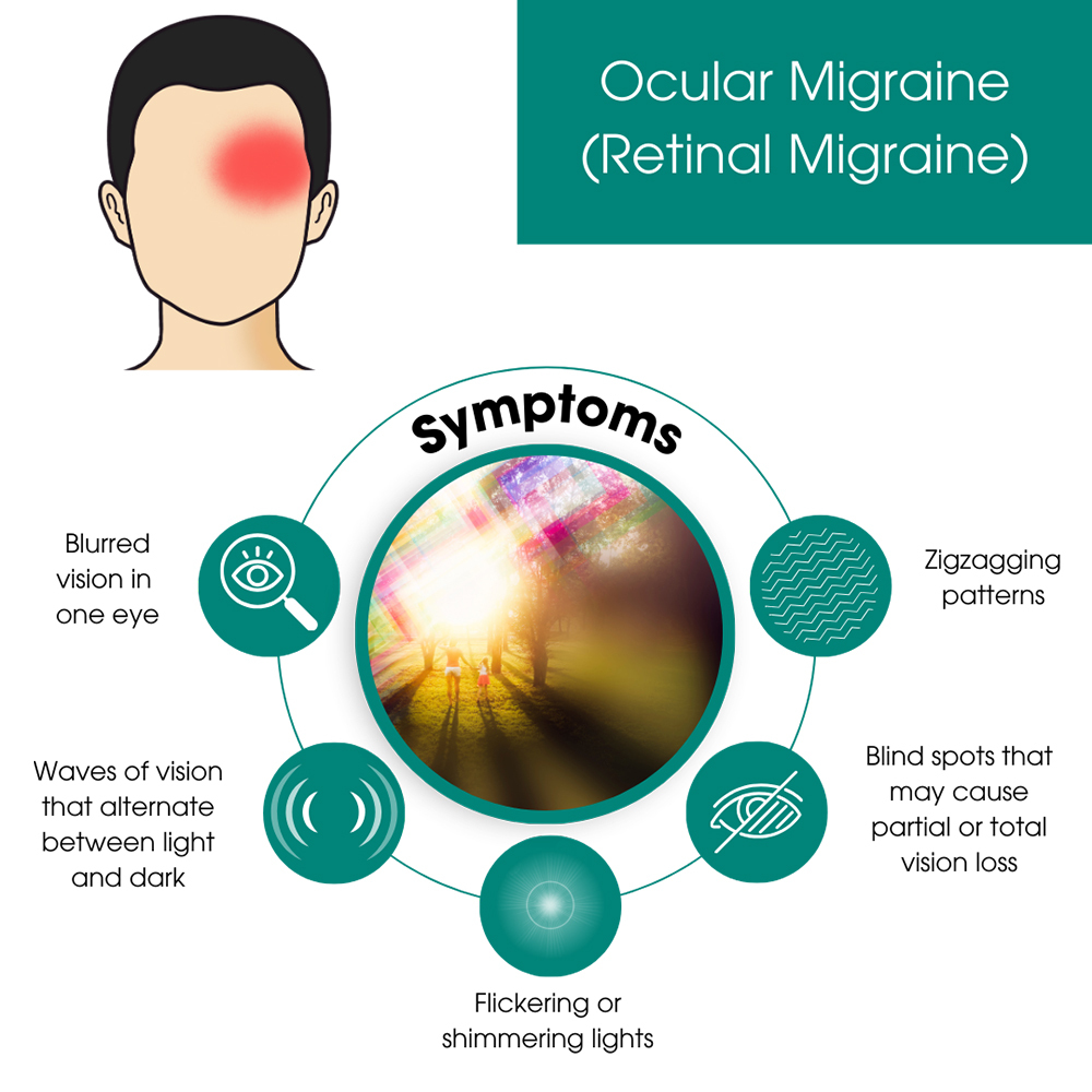 Ocular Migraine, Retinal Migraine